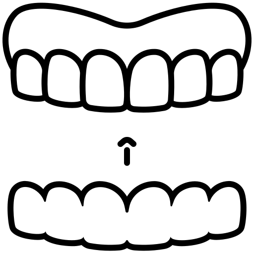 รีเทนเนอร์