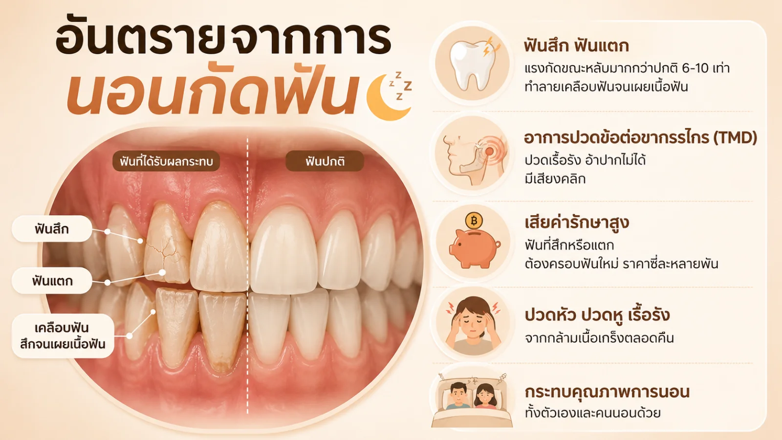 อินโฟกราฟิก อันตรายจากการนอนกัดฟัน