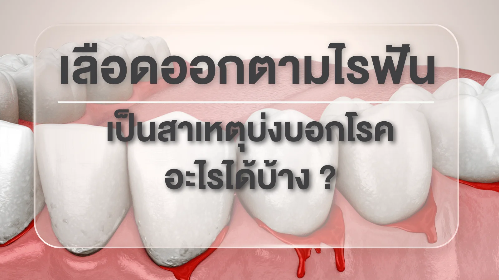 เหงือกสุขภาพดีดูยังไง เทียบกับเหงือกอักเสบ