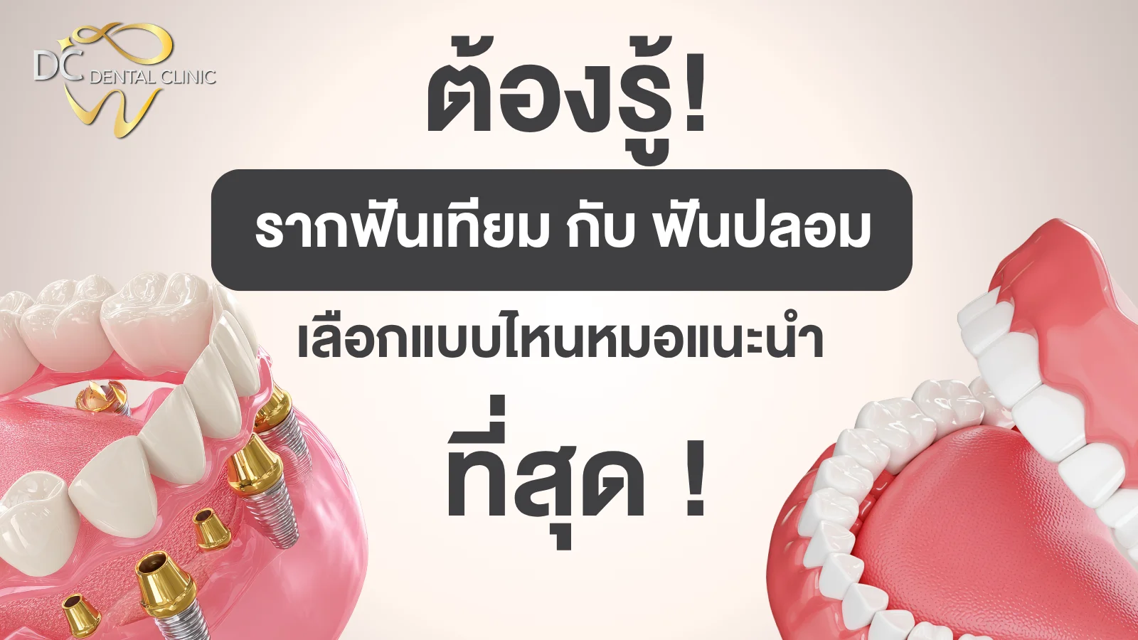 เปรียบเทียบรากฟันเทียมกับฟันปลอม เลือกแบบไหนดี