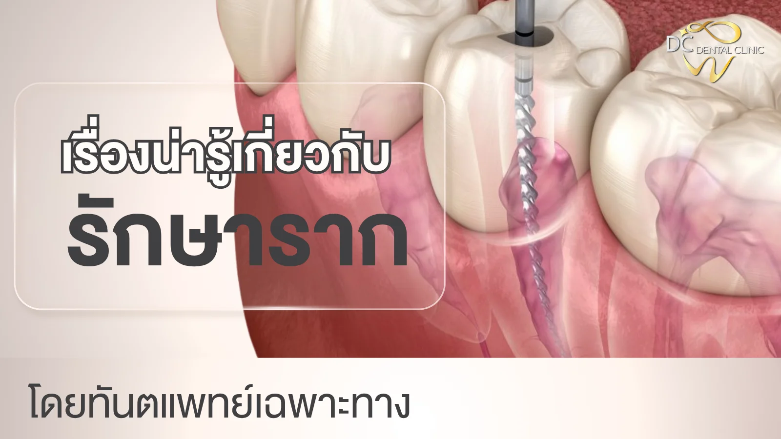 ขั้นตอนรักษารากฟัน โครงสร้างฟัน — DC Dental Clinic