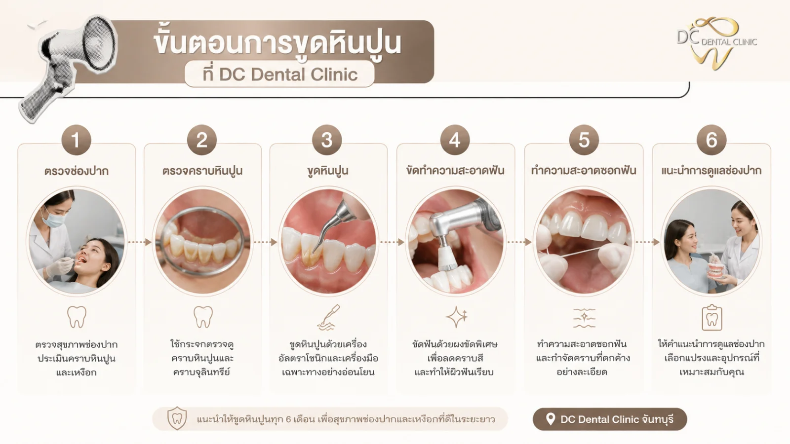 ขั้นตอนการขูดหินปูนที่ DC Dental Clinic