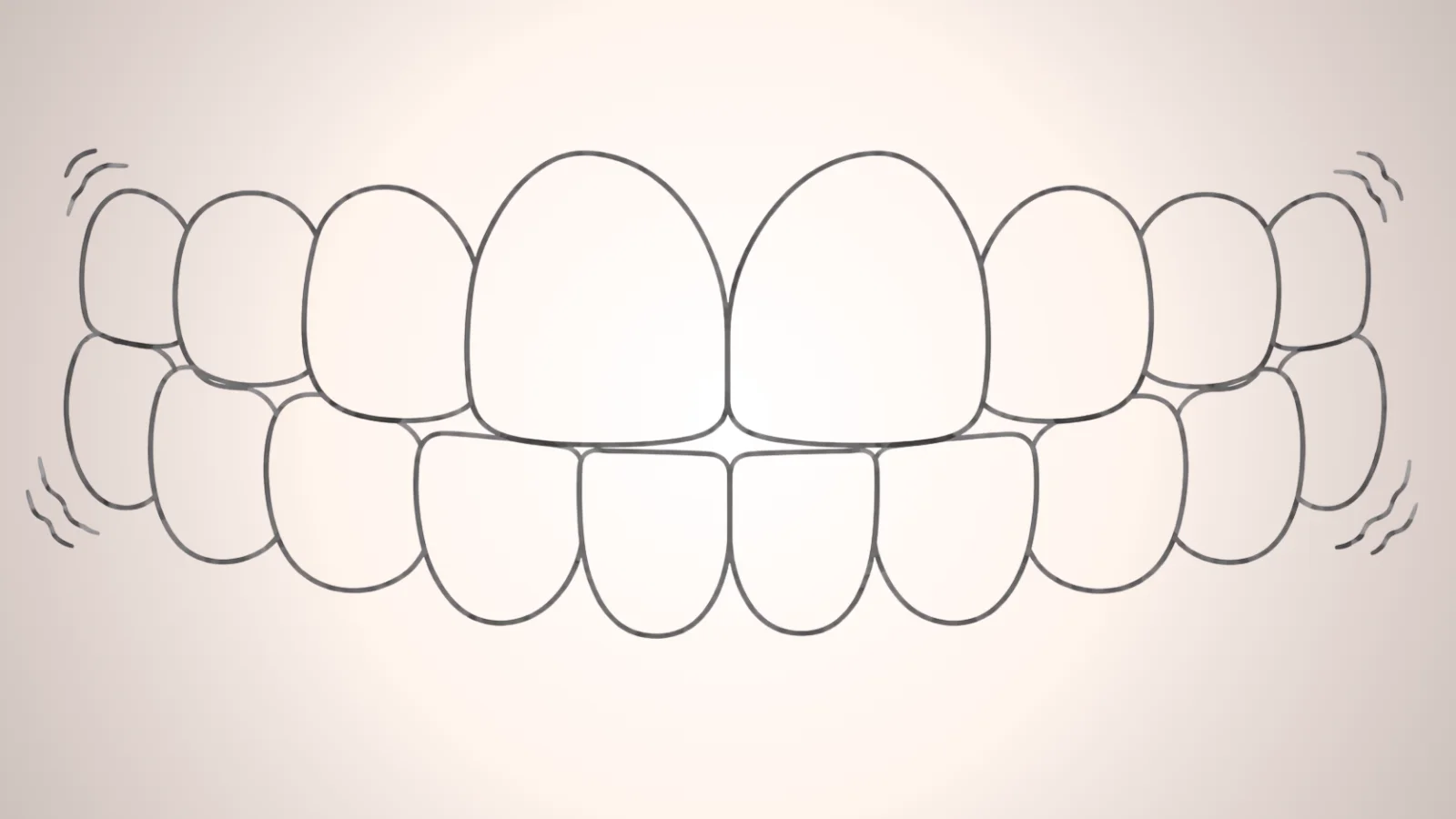 ภาพกราฟฟันโยก ฟันปลอมหลวม