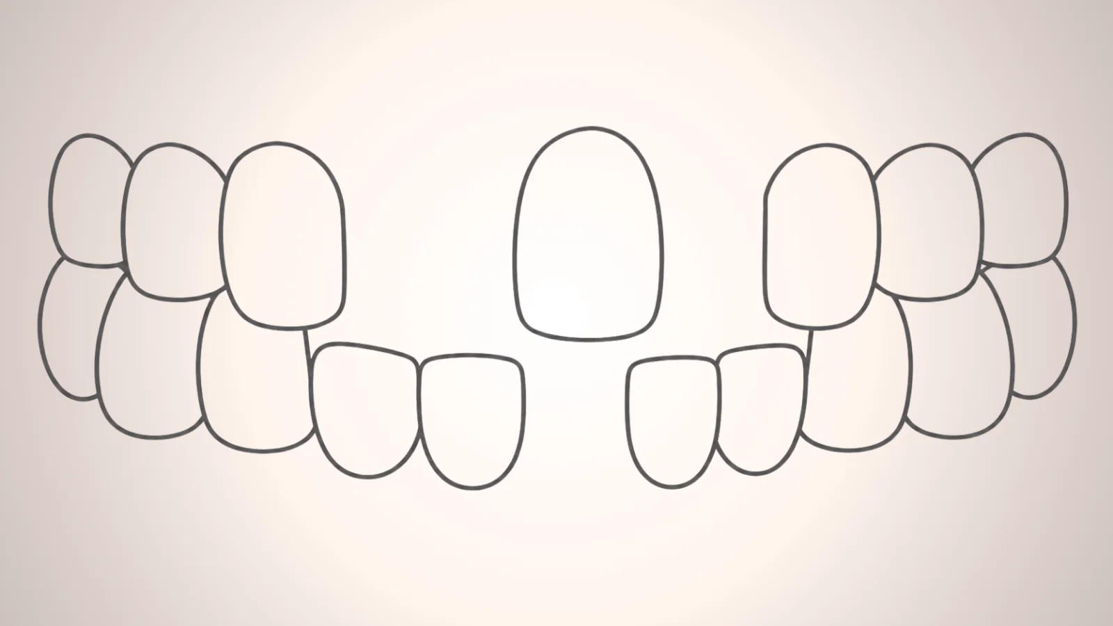 ภาพกราฟฟันหายหลายซี่