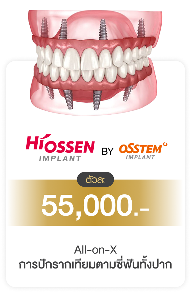 รากฟันเทียม จันทบุรี