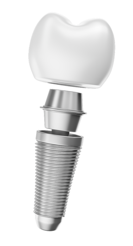 รากฟันเทียม จันทบุรี