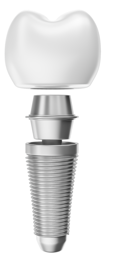 รากฟันเทียม จันทบุรี